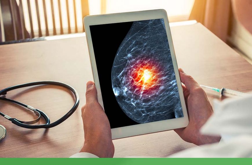 stages of breast cancer